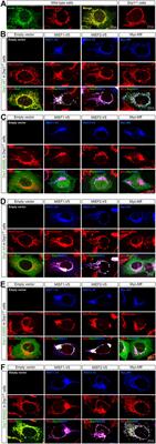 The Molecular Assembly State of Drp1 Controls its Association With the Mitochondrial Recruitment Receptors Mff and MIEF1/2